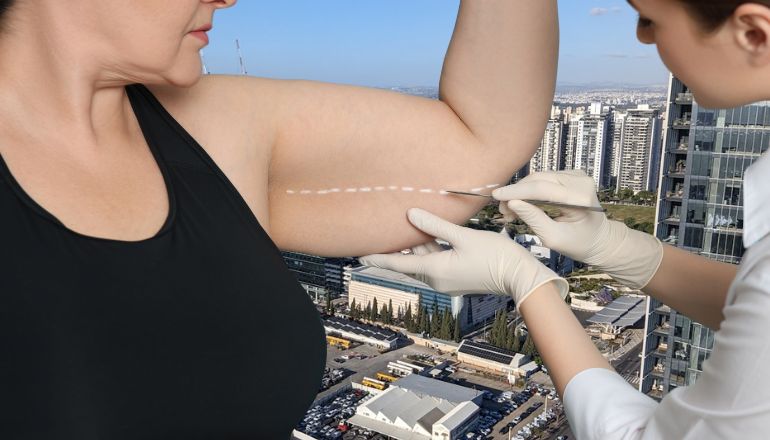 שאיבת שומן בפתח תקווה